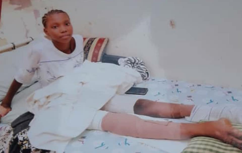 timbo-1 (05 Photos) Pikine : Voici la fille de 12 ans heurtée par le convoi du maire de Pikine, son pied a été amputé !
